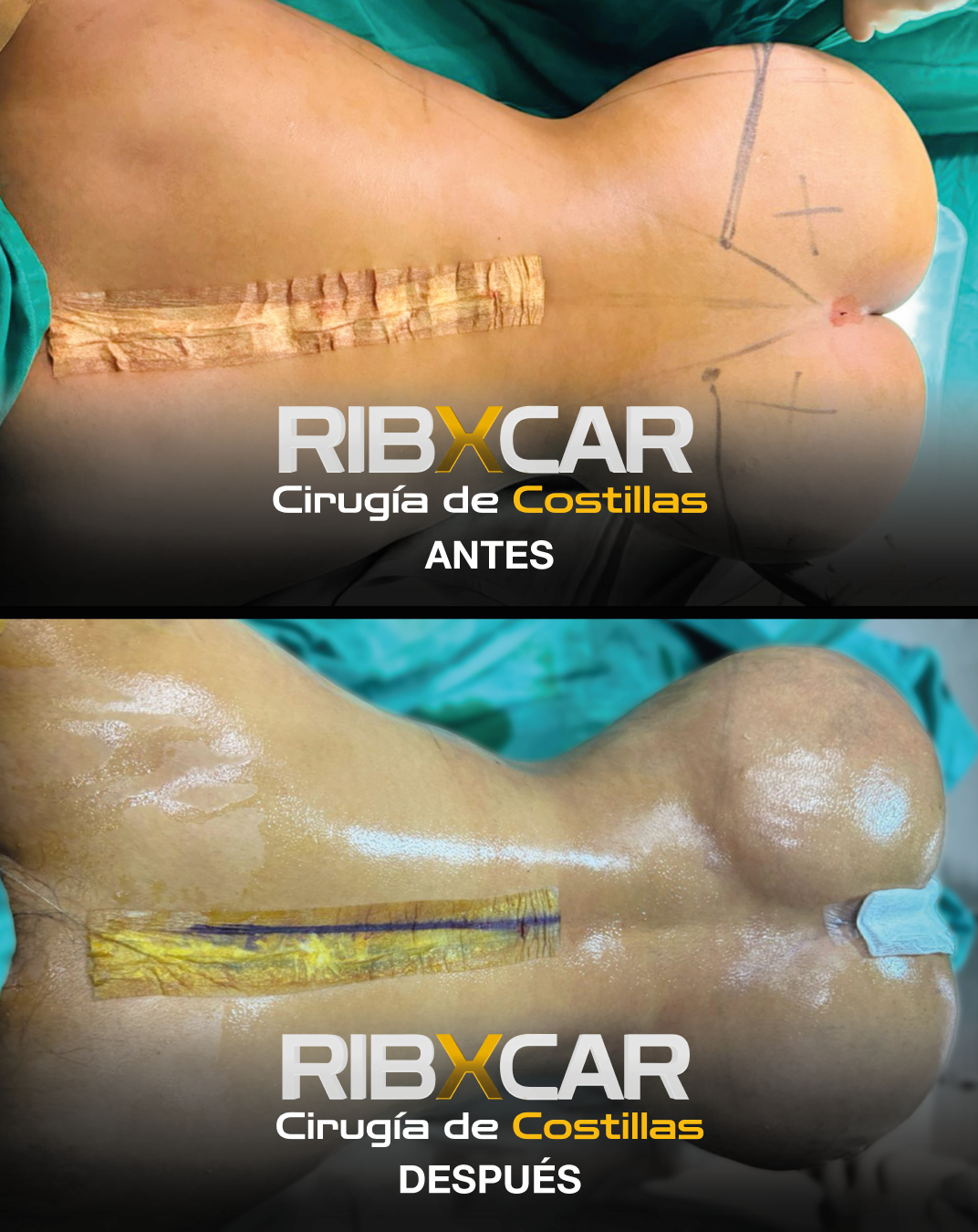 Case 02
