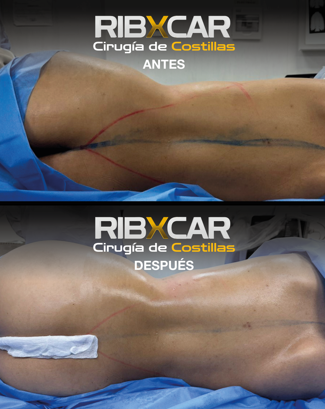 Case 03