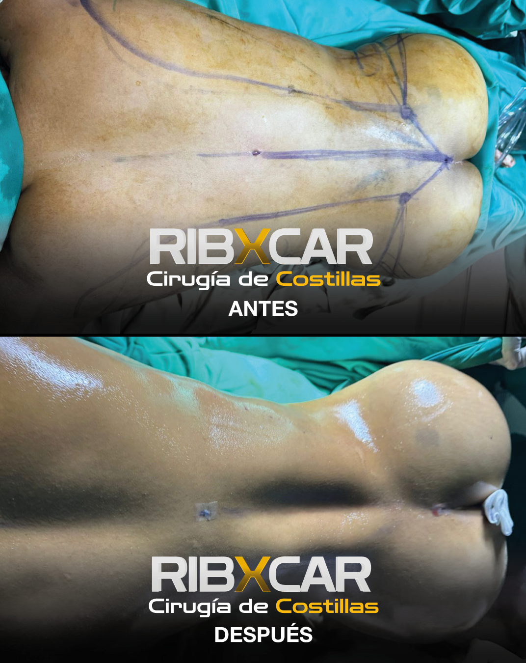 Case 04